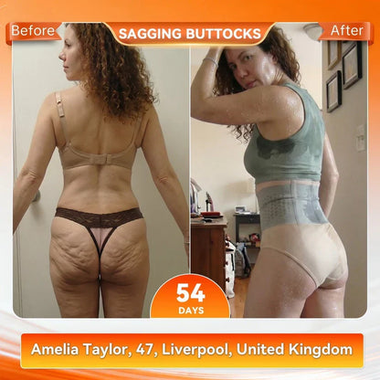 2026 New 4‑In‑1 Micro‑Particle Sculpting & Fat‑Burn Shorts